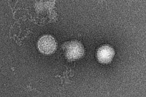 Imagen de microscopio del virus del Valle de Rift.