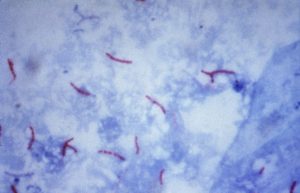 Imagen de Mycobacterium tuberculosis, la bacteria que afecta principalment a los humanos causando tuberculosis humana.