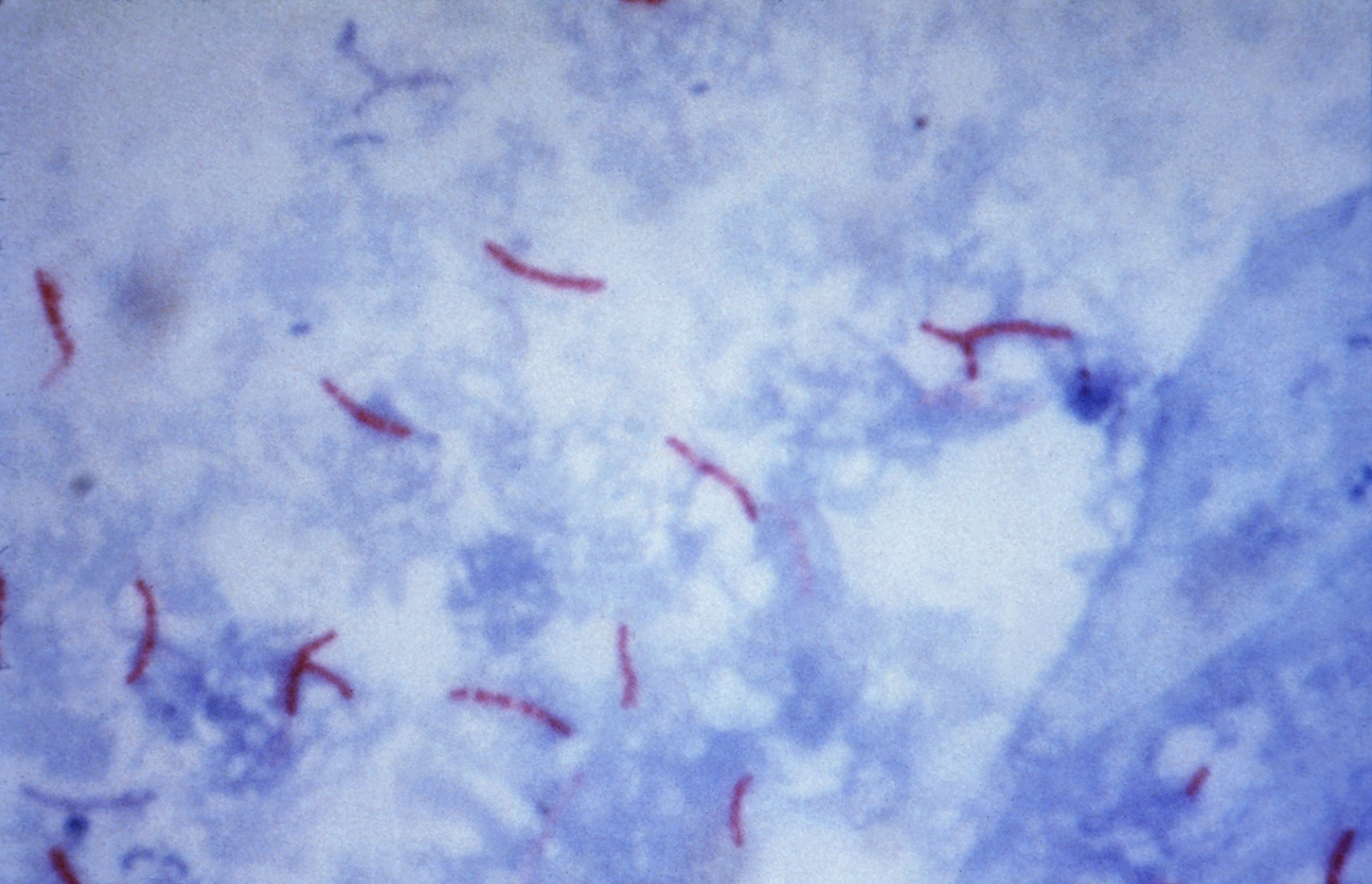 Imagen de Mycobacterium tuberculosis, la bacteria que afecta principalment a los humanos causando tuberculosis humana.